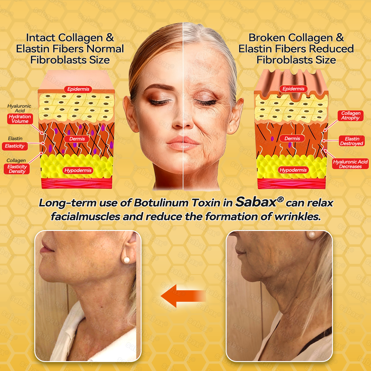🇺🇸𝑶𝒇𝒇𝒊𝒄𝒊𝒂𝒍 𝑺𝒕𝒐𝒓𝒆|𝑺𝒂𝒃𝒂𝒙® 𝐁𝐞𝐞 𝐕𝐞𝐧𝐨𝐦 & 𝐖𝐡𝐢𝐩𝐩𝐞𝐝 𝐓𝐚𝐥𝐥𝐨𝐰 𝐁𝐚𝐥𝐦 Skin Repair Cream (𝐉𝐮𝐬𝐭 𝐨𝐧𝐜𝐞 𝐚 𝐝𝐚𝐲, 𝐯𝐢𝐬𝐢𝐛𝐥𝐞 𝐜𝐡𝐚𝐧𝐠𝐞𝐬 𝐢𝐧 𝟕 𝐝𝐚𝐲𝐬) ✅ Targets Age Spots, Wrinkles, Eczema, Redness, Stretch Marks, and Even Joint Issues.