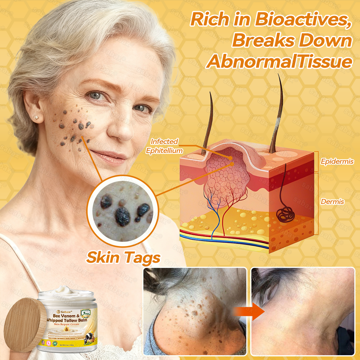 🇺🇸𝑶𝒇𝒇𝒊𝒄𝒊𝒂𝒍 𝑺𝒕𝒐𝒓𝒆|𝑺𝒂𝒃𝒂𝒙® 𝐁𝐞𝐞 𝐕𝐞𝐧𝐨𝐦 & 𝐖𝐡𝐢𝐩𝐩𝐞𝐝 𝐓𝐚𝐥𝐥𝐨𝐰 𝐁𝐚𝐥𝐦 Skin Repair Cream (𝐉𝐮𝐬𝐭 𝐨𝐧𝐜𝐞 𝐚 𝐝𝐚𝐲, 𝐯𝐢𝐬𝐢𝐛𝐥𝐞 𝐜𝐡𝐚𝐧𝐠𝐞𝐬 𝐢𝐧 𝟕 𝐝𝐚𝐲𝐬) ✅ Targets Age Spots, Wrinkles, Eczema, Redness, Stretch Marks, and Even Joint Issues.