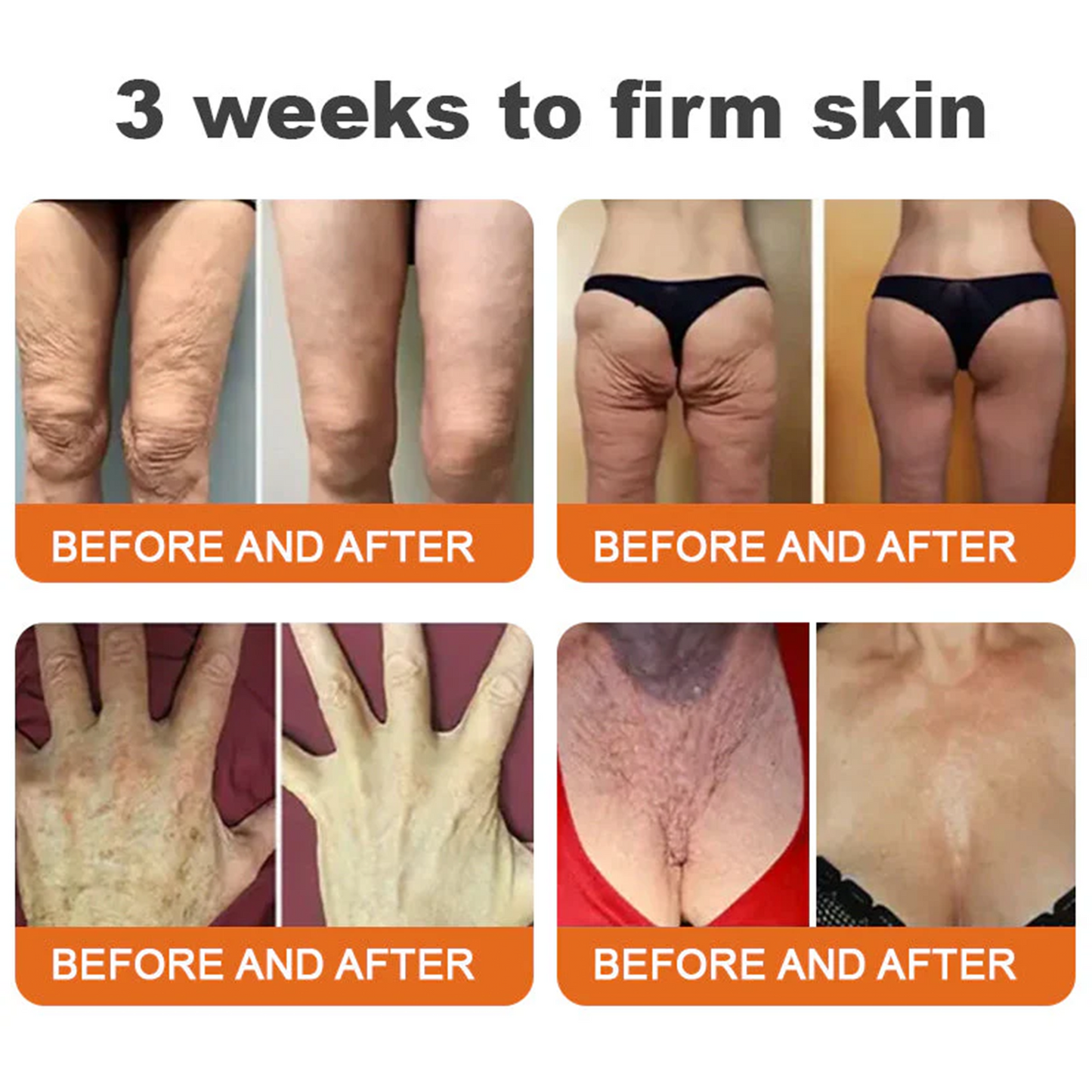 🇺🇸𝑶𝒇𝒇𝒊𝒄𝒊𝒂𝒍 𝑺𝒕𝒐𝒓𝒆|𝑺𝒂𝒃𝒂𝒙® 𝐁𝐞𝐞 𝐕𝐞𝐧𝐨𝐦 & 𝐖𝐡𝐢𝐩𝐩𝐞𝐝 𝐓𝐚𝐥𝐥𝐨𝐰 𝐁𝐚𝐥𝐦 Skin Repair Cream (𝐉𝐮𝐬𝐭 𝐨𝐧𝐜𝐞 𝐚 𝐝𝐚𝐲, 𝐯𝐢𝐬𝐢𝐛𝐥𝐞 𝐜𝐡𝐚𝐧𝐠𝐞𝐬 𝐢𝐧 𝟕 𝐝𝐚𝐲𝐬） ✅ Targets Age Spots, Wrinkles, Eczema, Redness, Stretch Marks, and Even Joint Issues.