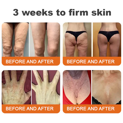 🇺🇸𝑶𝒇𝒇𝒊𝒄𝒊𝒂𝒍 𝑺𝒕𝒐𝒓𝒆|𝑺𝒂𝒃𝒂𝒙® 𝐁𝐞𝐞 𝐕𝐞𝐧𝐨𝐦 & 𝐖𝐡𝐢𝐩𝐩𝐞𝐝 𝐓𝐚𝐥𝐥𝐨𝐰 𝐁𝐚𝐥𝐦 Skin Repair Cream (𝐉𝐮𝐬𝐭 𝐨𝐧𝐜𝐞 𝐚 𝐝𝐚𝐲, 𝐯𝐢𝐬𝐢𝐛𝐥𝐞 𝐜𝐡𝐚𝐧𝐠𝐞𝐬 𝐢𝐧 𝟕 𝐝𝐚𝐲𝐬） ✅ Targets Age Spots, Wrinkles, Eczema, Redness, Stretch Marks, and Even Joint Issues.